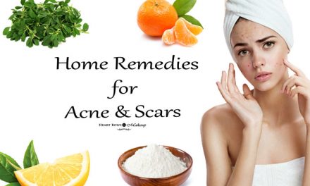 Home Remedies To Treat Pimples